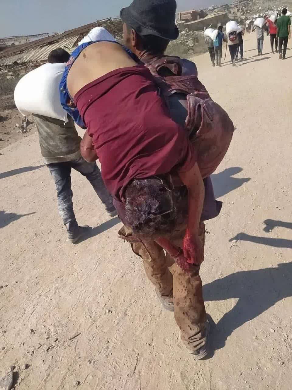 کودکان غزه با گرسنگی، رسوایی تمدنِ دروغین را امضا می‌کنند